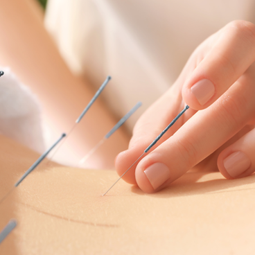 A person receiving an acupuncture treatment.